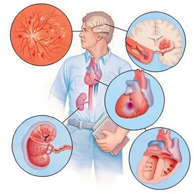 Cardiol voorkomt de ontwikkeling van bijkomende ziekten